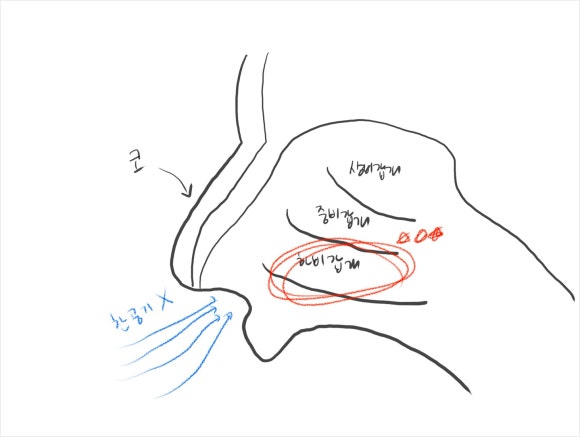 후비루 증후군, 목에 걸리는 느낌 이 방법이면 없어져요.