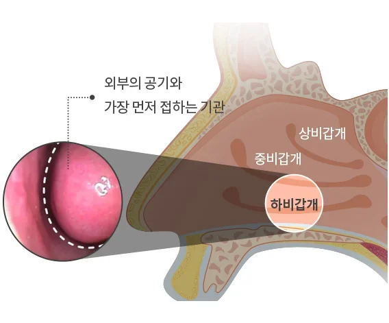 아이 부비동염 열, 원인부터 확인해야 하는 이유