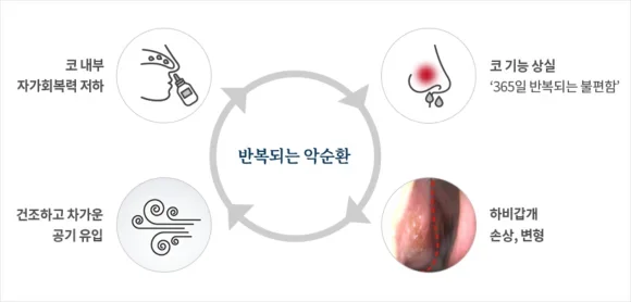 마른기침과 가래기침|코 기능 상실과 하비갑개 손상의 반복되는 악순환 설명 인포그래픽
