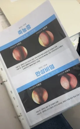 아기 축농증 항상제|라경찬한의원 비염관련 책자